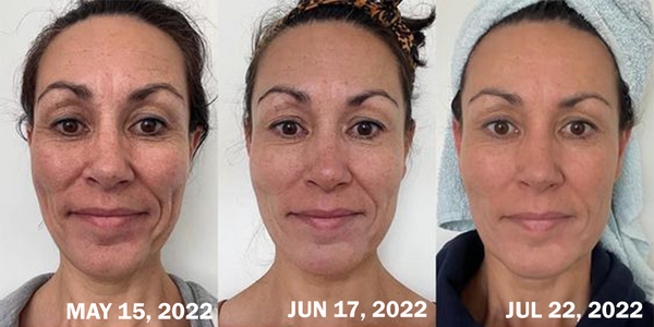 BlancoDerma crema facial Aclarante e Hidratante uso Nocturno 2x1