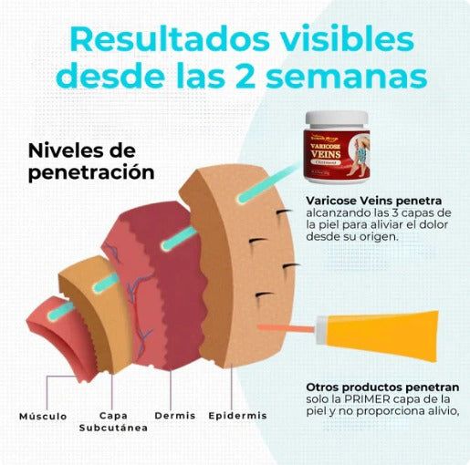 Varicose Veins™ Alivio Natural y Visible para tus Piernas con Várices