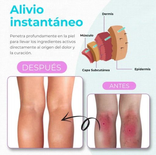 Varicose Veins™ Alivio Natural y Visible para tus Piernas con Várices