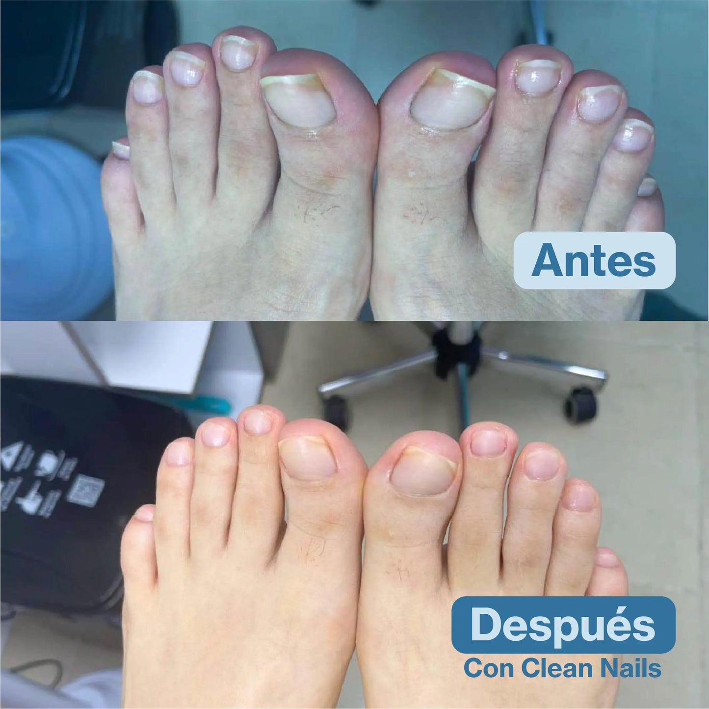 Clean Nails™ Elimina Hongos y Fortalece tus Uñas 2x1