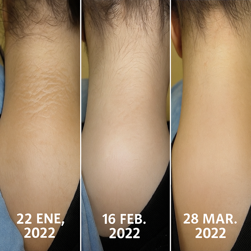 BlancoDerma crema facial Aclarante e Hidratante uso Nocturno 2x1