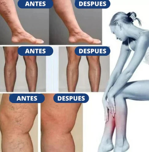 CircuVive™ Parche Revitalizante Piernas Circulación Varices 3x1