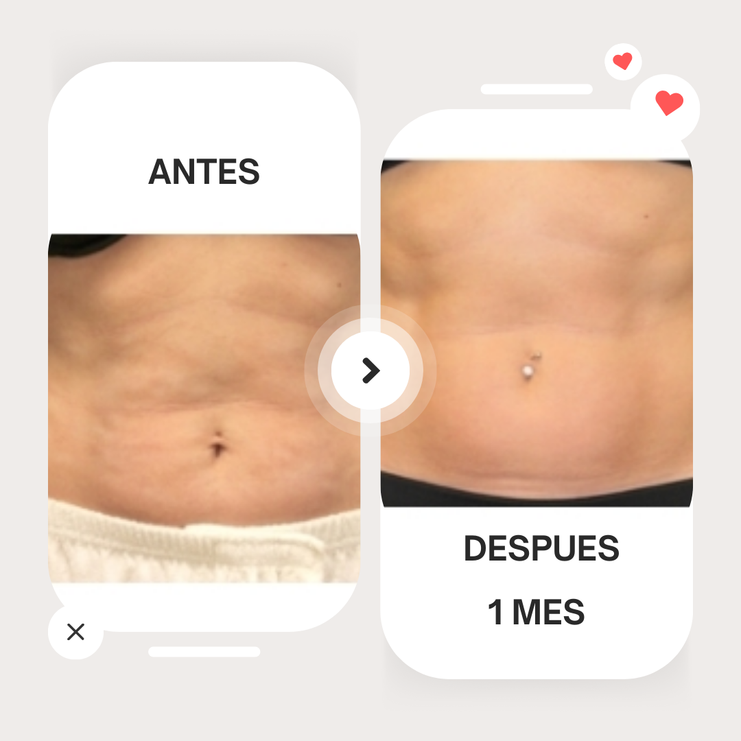 SlimVibe Pro Tu Aliado para un Cuerpo Tonificado y Libre de Estrés