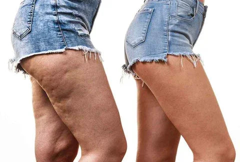 PaSel® Piel firme, lisa y sin marcas desde la 1ª semana 2x1