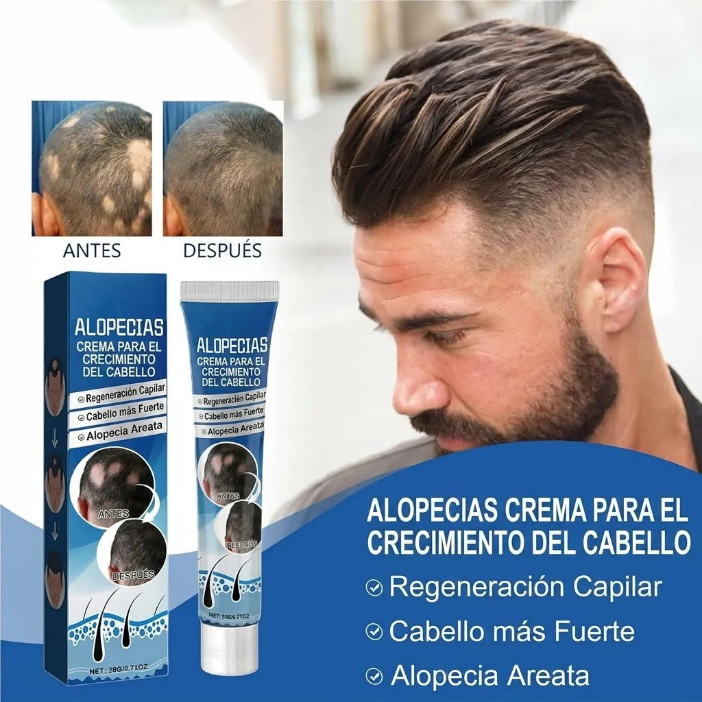 Capilex™ Crema para el Crecimiento Capilar ¡3x1! – MexSelect