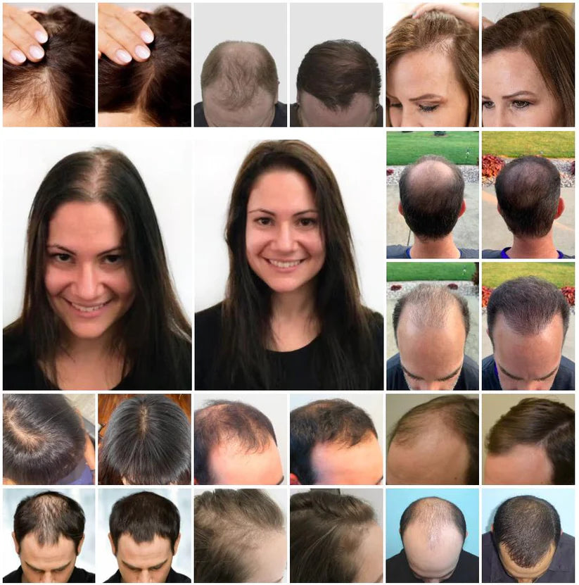 Elhoe™ Capilar tónico crecimiento capilar acelerado 2x1