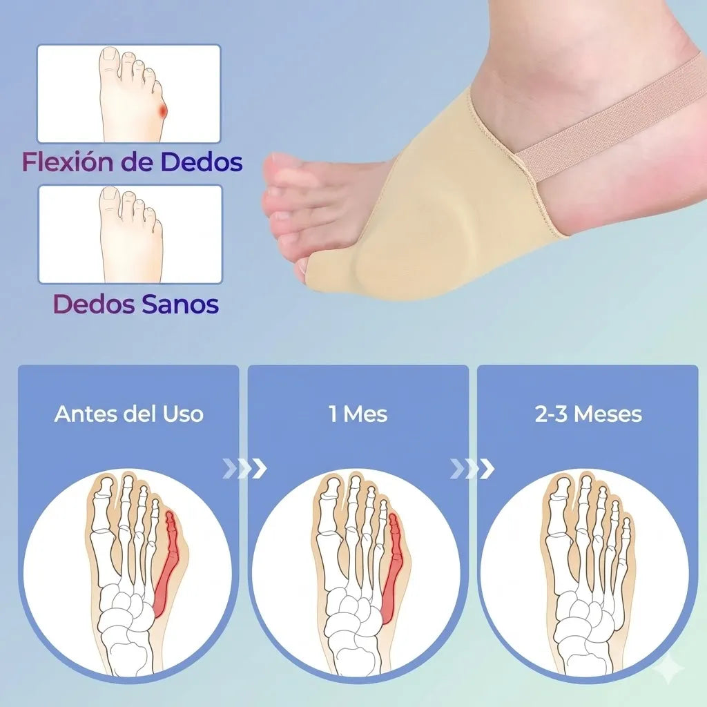 Juanet Comfort™ Corrector Ortopédico de Juanetes