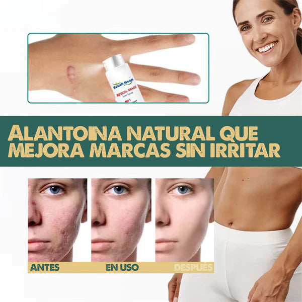 South Moon™ Spray Avanzado para las Cicatrices y Queloides