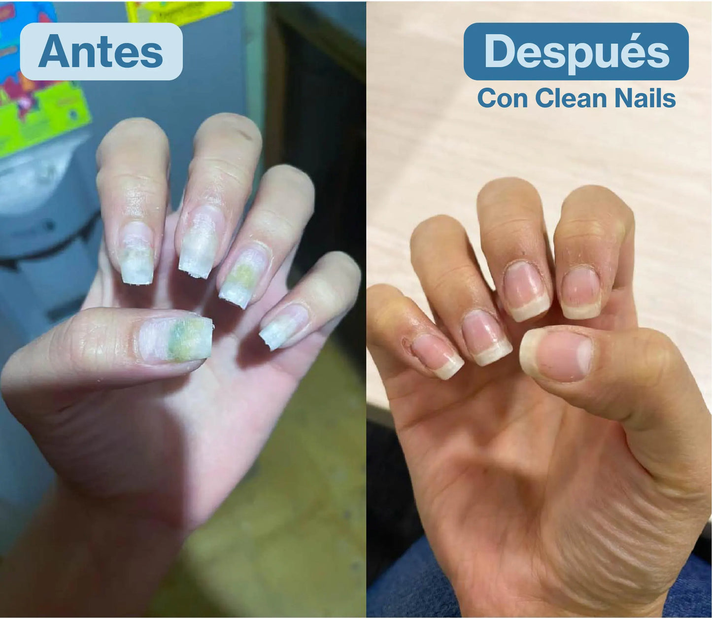 Clean Nails™ Elimina Hongos y Fortalece tus Uñas 2x1