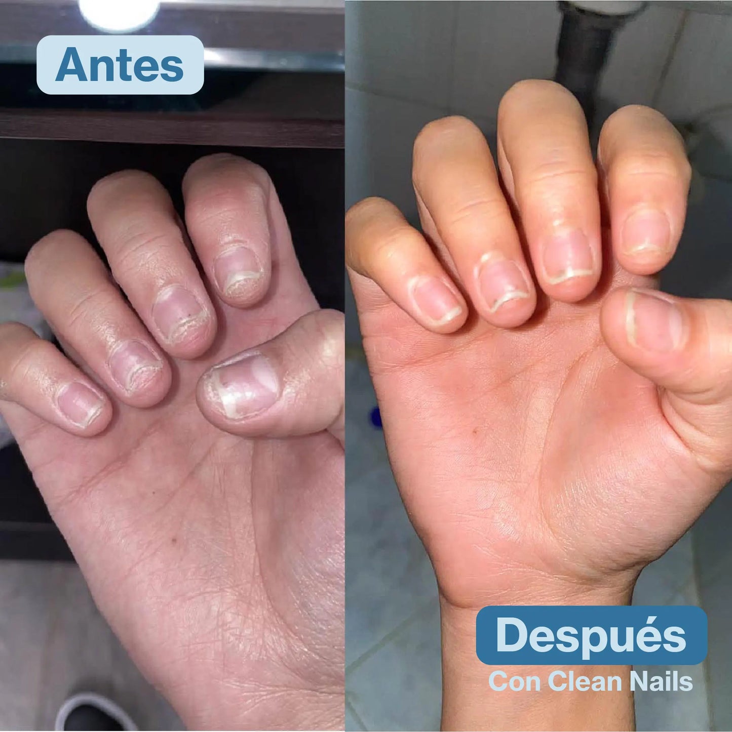 Clean Nails™ Elimina Hongos y Fortalece tus Uñas 2x1