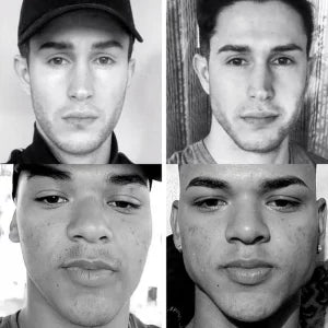 JawForce™ Esculpe tu mandíbula, fortalece tu perfil y potencia tu presencia