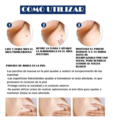 FormuClear Parches Anti Verrugas ¡216 parches!