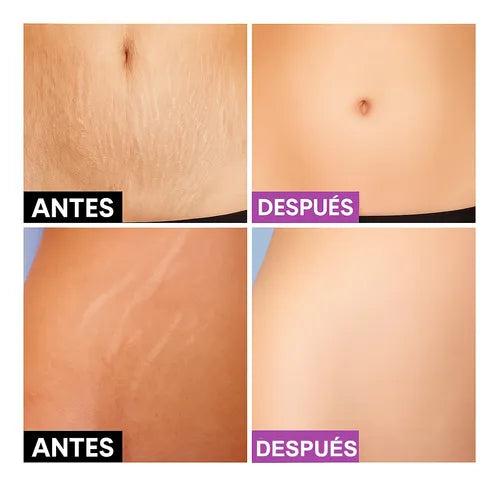 PaSel® Piel firme, lisa y sin marcas desde la 1ª semana 2x1