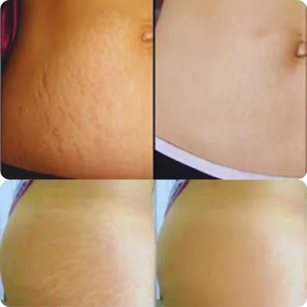 PaSel® Piel firme, lisa y sin marcas desde la 1ª semana 2x1