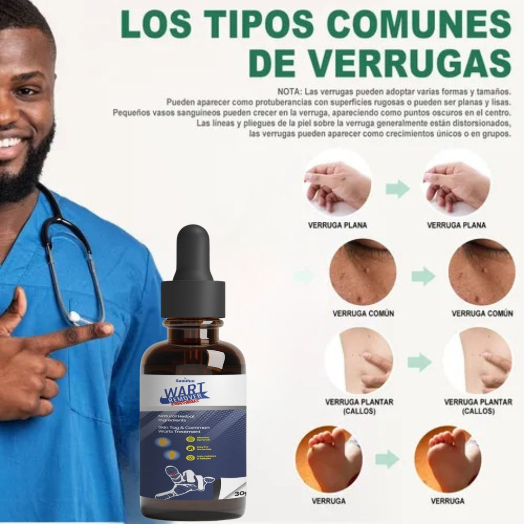 Wart Remover™ Elimina Verrugas sin Irritar tu Piel