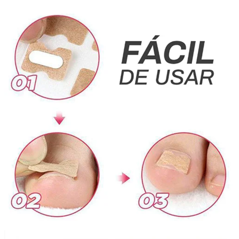 UñaLibre® Corrector Natural para Uñas Encarnadas y Hongos 2x1